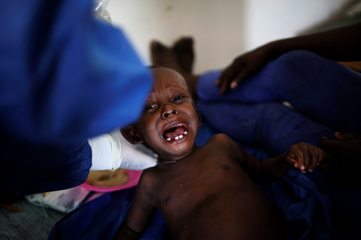 A child is being treated at the cholera treatment center at the hospital after Hurricane Matthew passes in Jeremie, Haiti