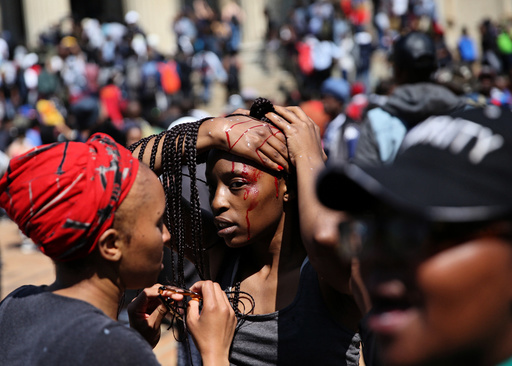 An injured student is attended to by her schoolmates after clashes with security at Johannesburg's University of the Witwatersrand on Tuesday, as countrywide protests demanding free tertiary education entered a third week