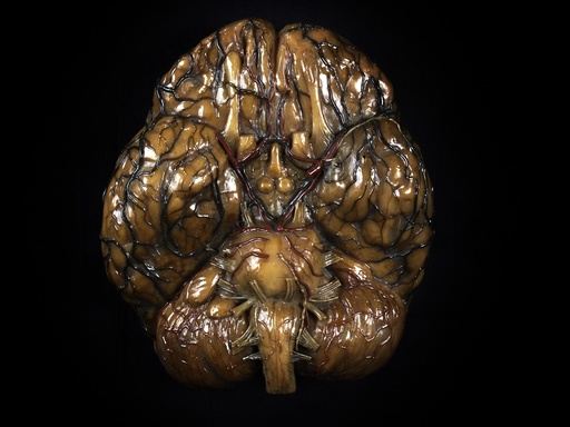 Brain model, 18th century