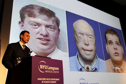 Dr. Eduardo D. Rodriguez holds news conference to announce successful face transplant operation at NYU Langone Medical Center in New York