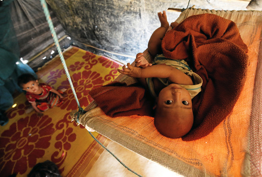 A Rohingya refugee child reacts to the camera as lies on a cradle at Kutupalang Unregistered Refugee Camp