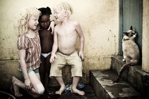 Albino siblings Caroline and Fernandes, play with their cousin Taina outside their home in the V9 slum of Olinda
