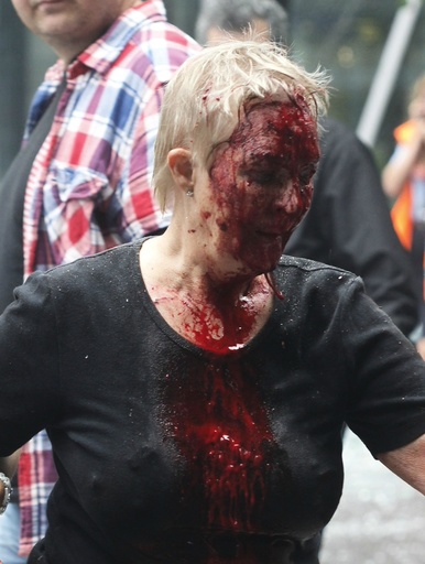 An injured woman, among others, leave the site of a powerful explosion that rocked central Oslo
