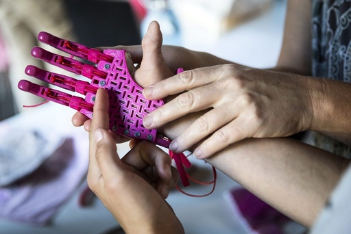 3D-printed prosthetic hand presented in Budapest