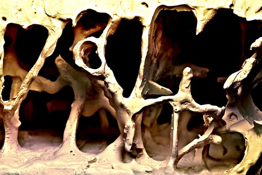 Osteoporosis bone structure