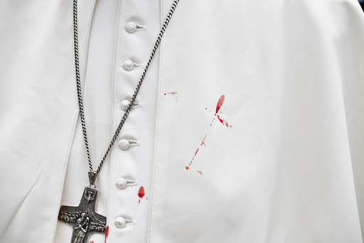 A few droplets of blood stain Pope Francis' white tunic from a bruise around his left eye and eyebrow caused by an accidental hit against the popemobile's window glass while visiting the old sector of Cartagena