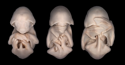 Bat embryos, light micrograph