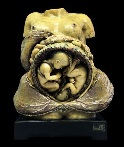 Twin pregnancy model, 18th century