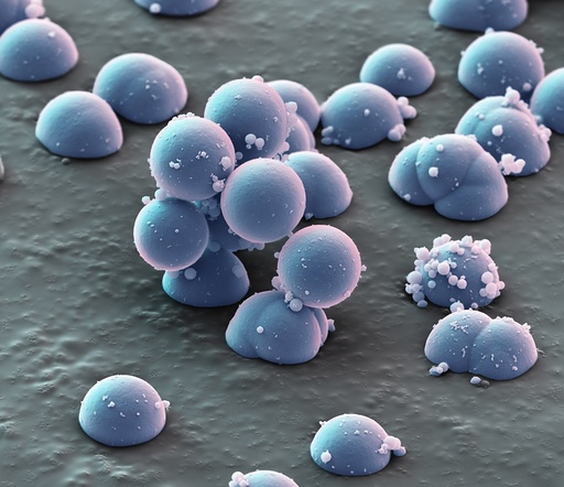 Microsphere filter particles, SEM
